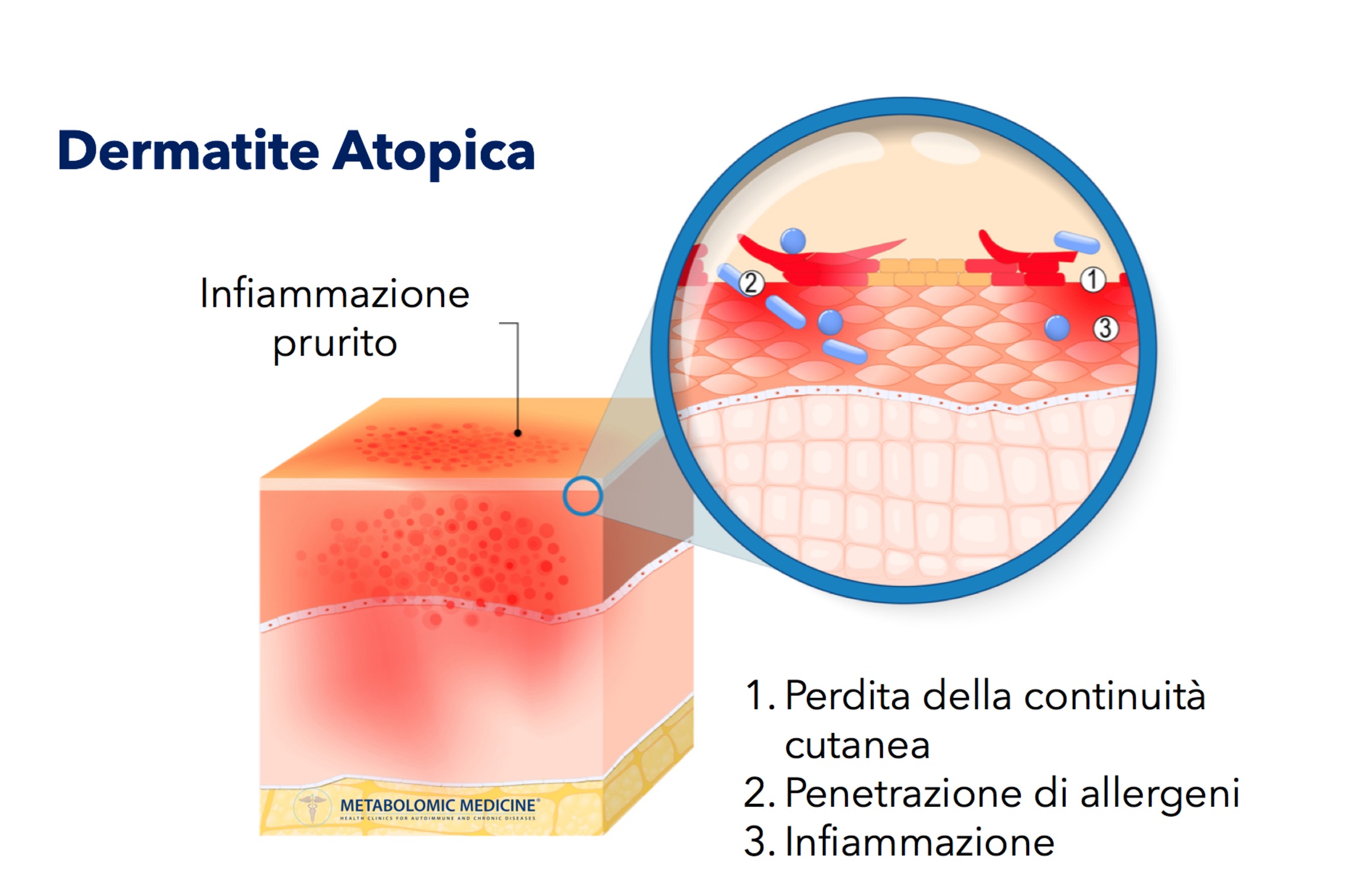 Cresci mite periodo omega 3 dermatite atopica Massa deserto Versare